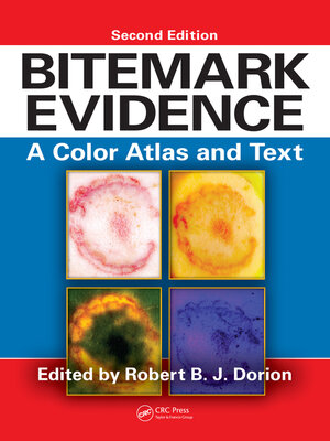 cover image of Bitemark Evidence